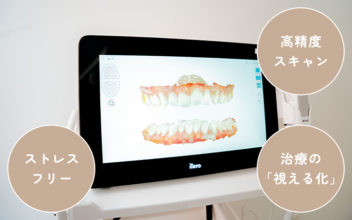 より精確に、より効率的に口腔内スキャナー「iTero（アイテロ）」